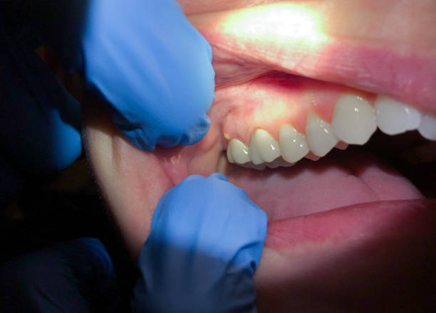 Best Pediatric Emergency Dentist in Belford, NJ